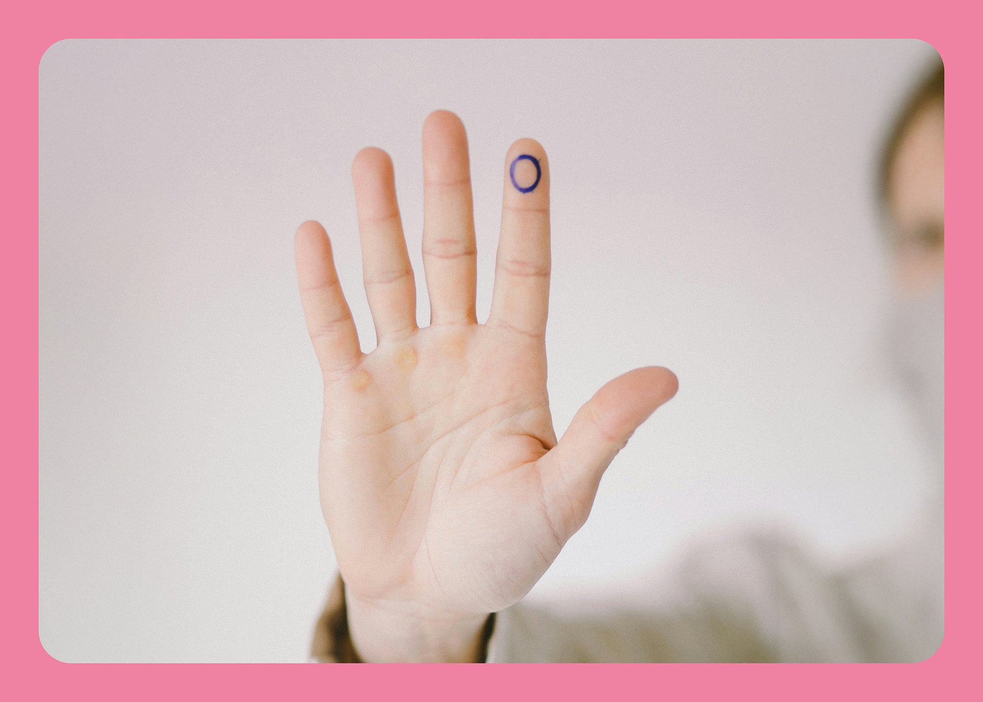 Diabetes ist nicht gleich Diabetes